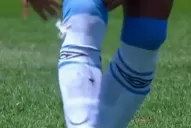 Video: al Pulguita le rompieron la media de un planchazo