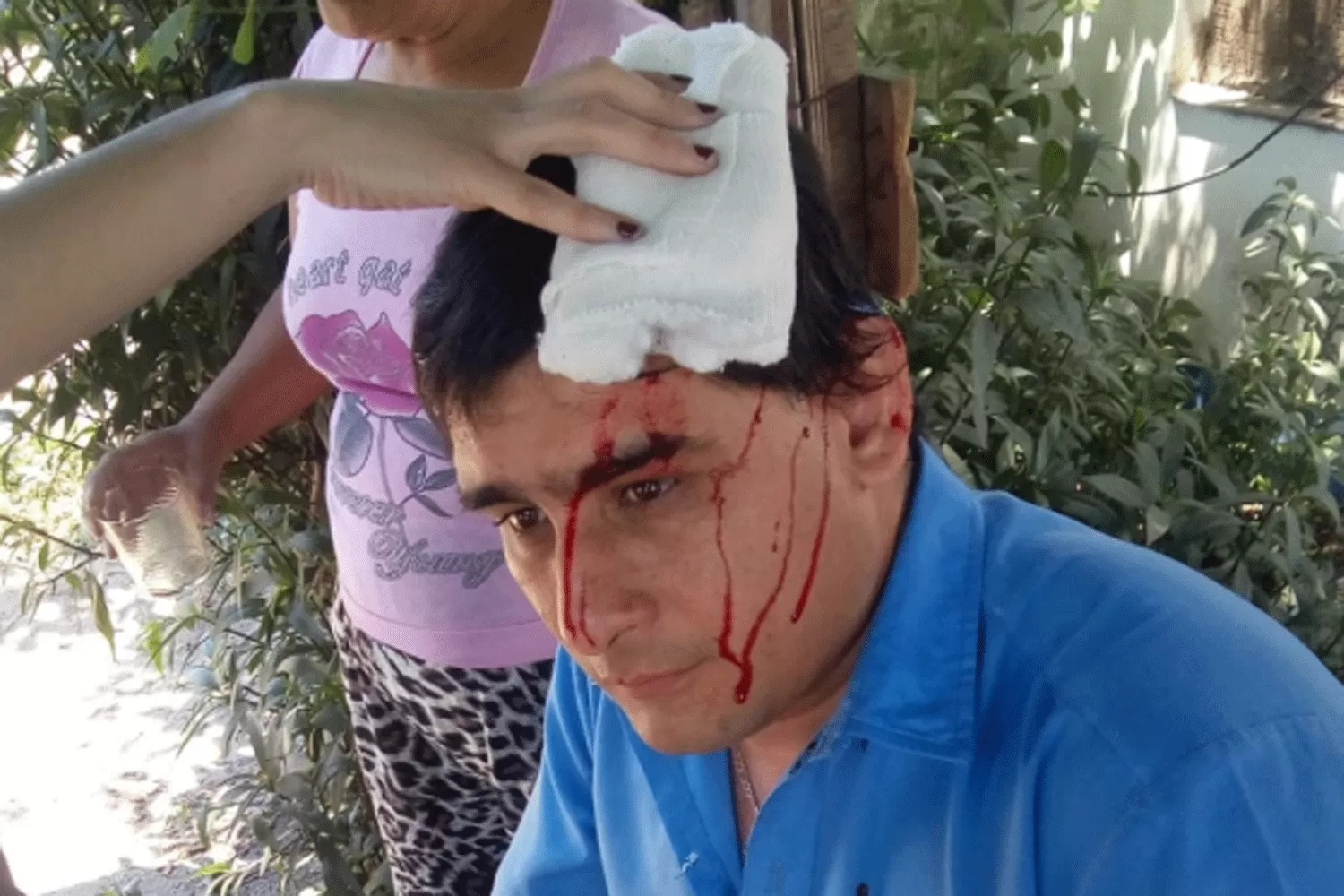HERIDO. Díaz recibió varios puntos de sutura en la cabeza.