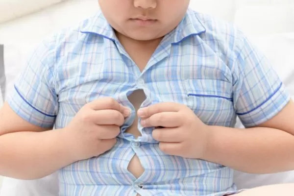 La obesidad es una amenaza seria para la salud de los niños