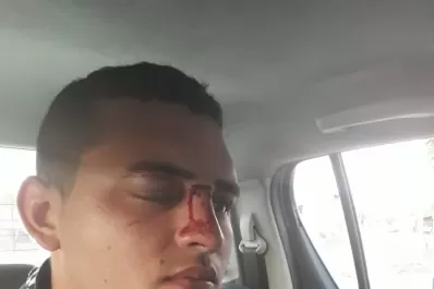 Le pegaron a un policía con un palo en la cabeza para robarle la moto