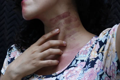En Tucumán aumentó un 20% la cantidad de consultas por casos de violencia familiar