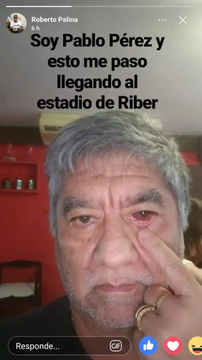 Palina, otra vez en las redes: del Pommery al ojo herido de Pablo Pérez