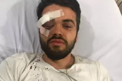 Golpearon salvajemente a un joven por ser gay y los condenaron a tres años de prisión