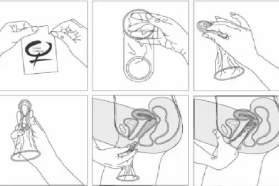Condón vaginal: para conocerlo mejor