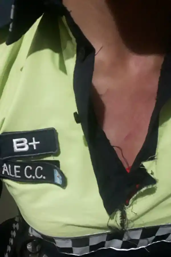 PRUEBA. La mujer que denunció a Sandoval y las marcas en su cuerpo.