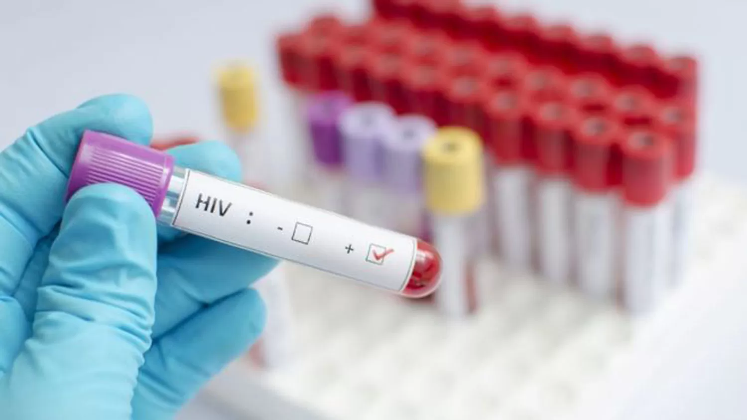 Confirmaron que un hombre con VIH fue curado: es el segundo caso de la historia