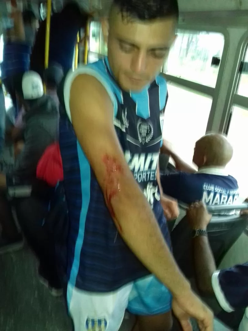 HERIDO. Diego Díaz sufrió una herida cortante en el codo derecho.  