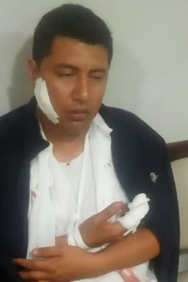 DAVID MEDINA. El chofer heriodo.