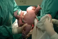 Unas 170 licenciadas en obstetricia podrían recetar y colocar anticonceptivos en Tucumán