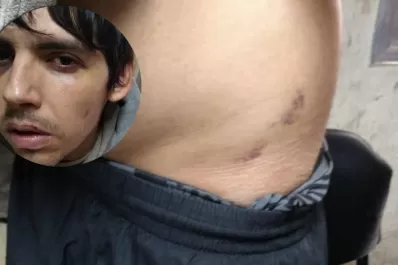 Estas son las lesiones que sufrió el recluso atacado en Villa Urquiza