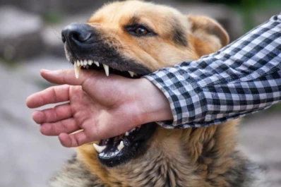 Qué hacer ante la mordedura de un perro o un arañazo de gato