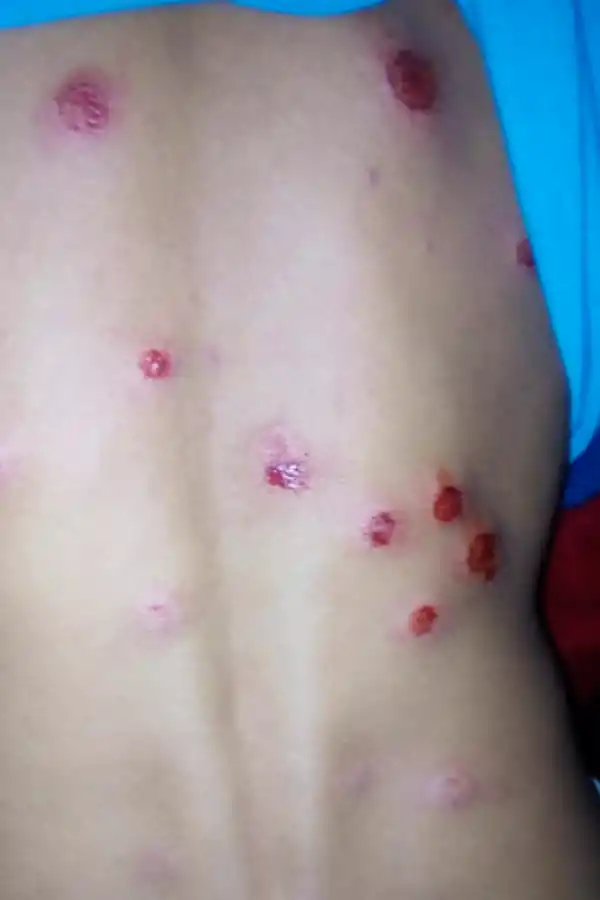 Disturbios y balas de goma en El Naranjo por los resultados del domingo