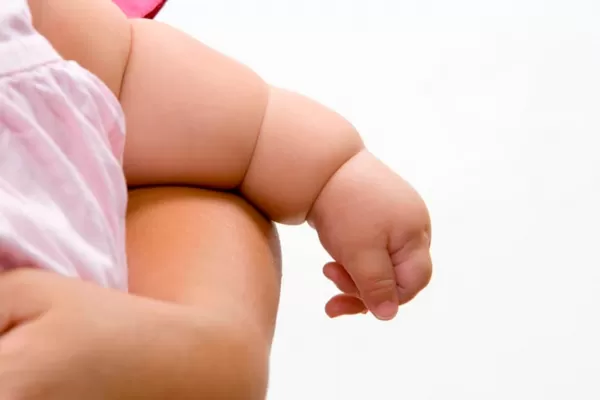 Advierten que en Tucumán hay casos de obesidad infantil a partir de los seis meses