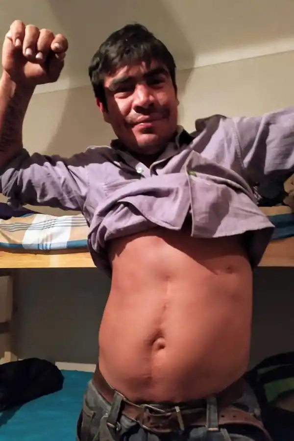 MARCAS DEL PASADO. Manuel se ríe de las cicatrices que tiene, tras la 