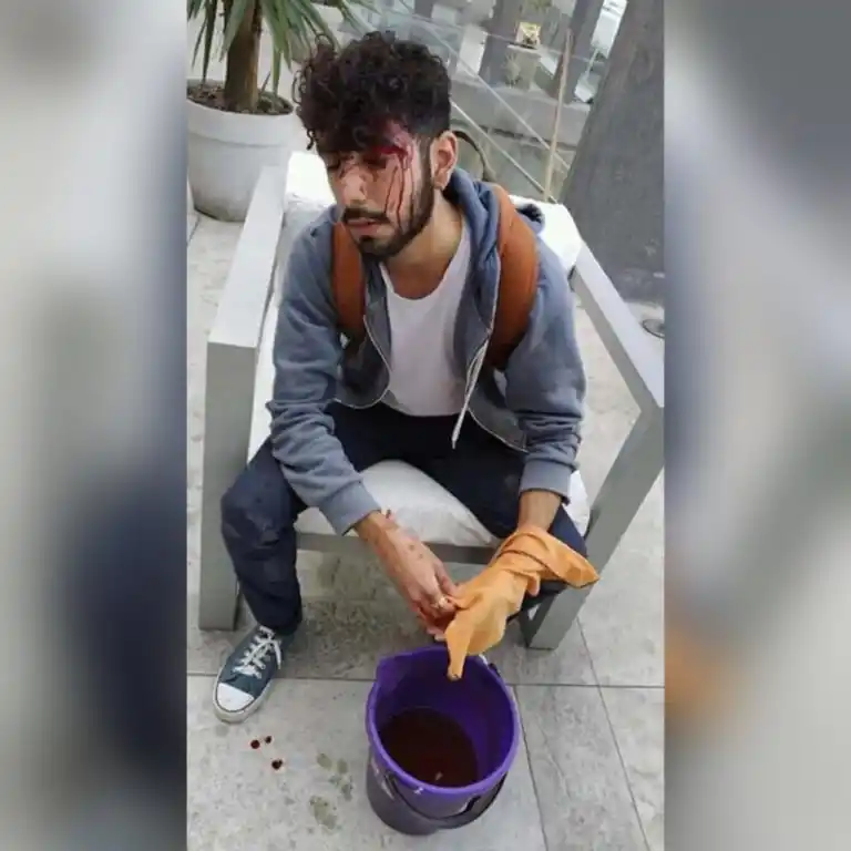 Lucas fue asistido en la Hostería de Tafí Viejo, donde recibió primeros auxilios.