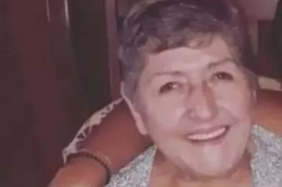 Murió la mujer a la que le amputaron la pierna equivocada