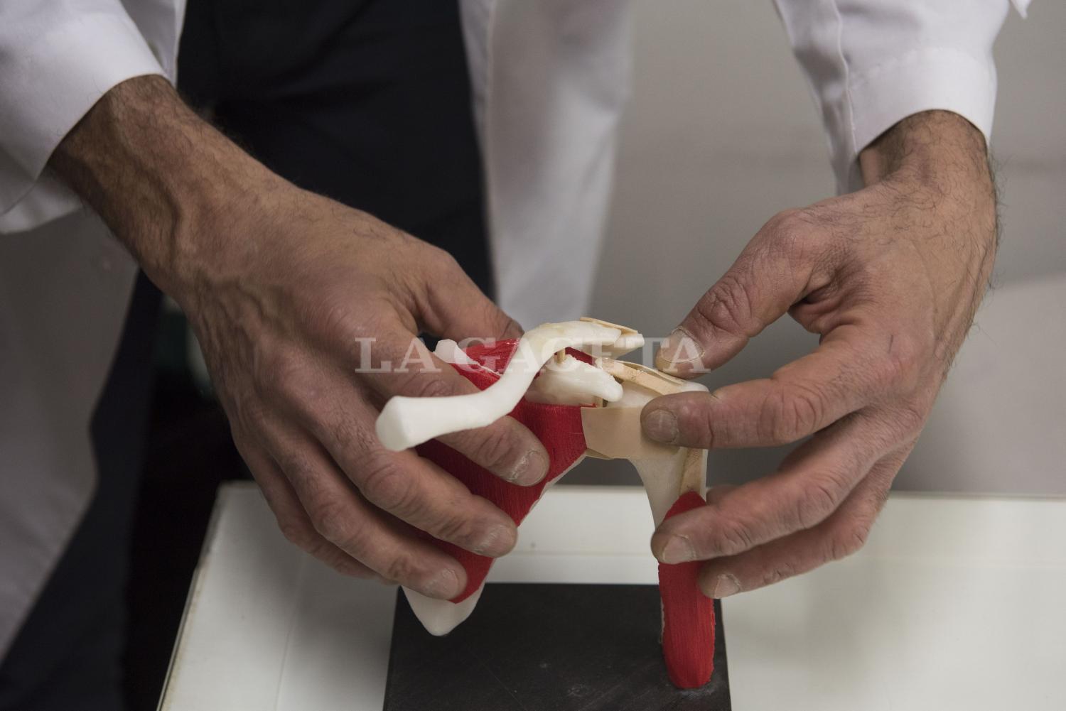 Los médicos imprimen en 3D las lesiones para explicarles con claridad a los pacientes sus dolencias.