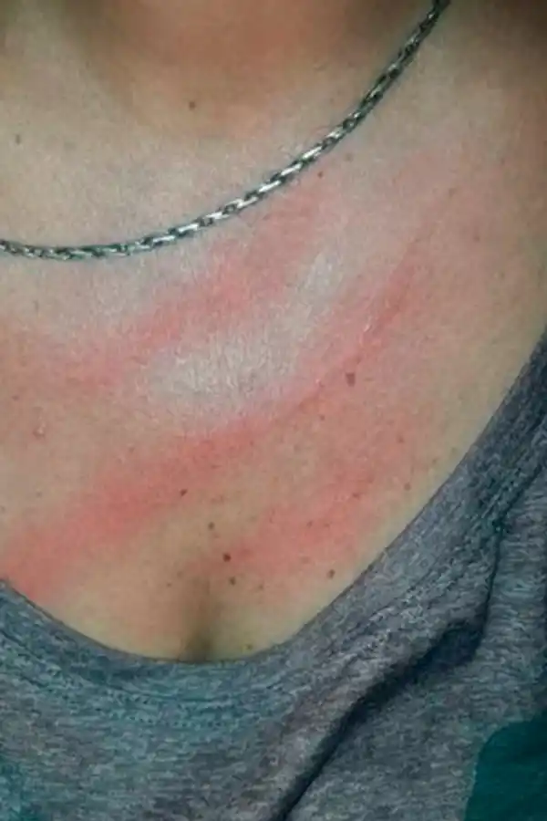 La foto que colgó la locutora en sus redes sociales después de la agresión.