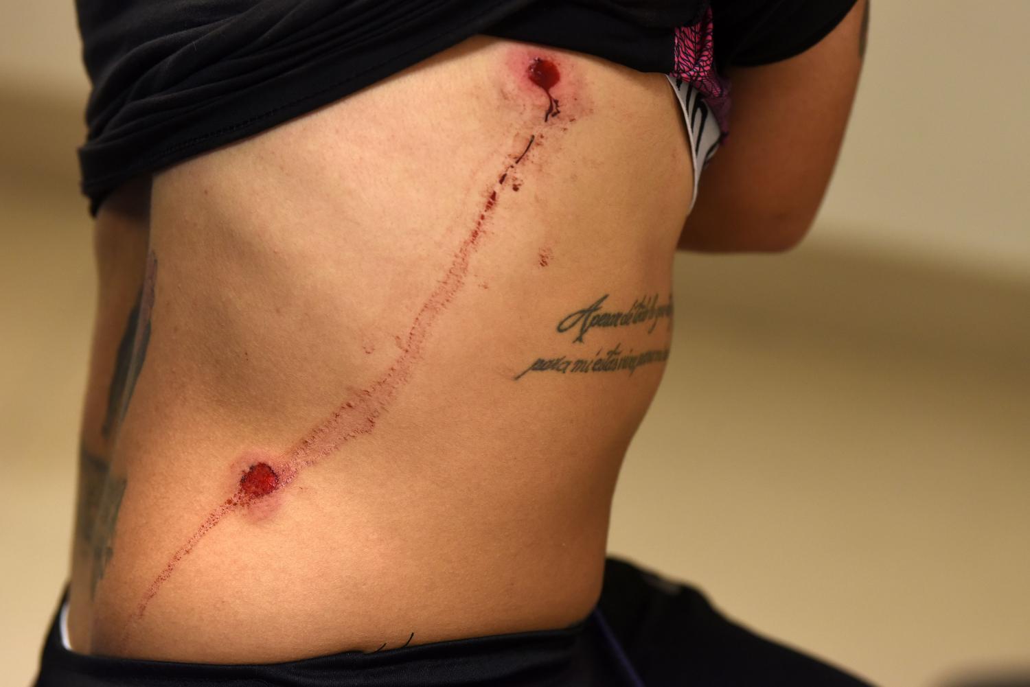 LESIONADA. Rocío Correa, jugadora de la Selección de fútbol, resultó herida.