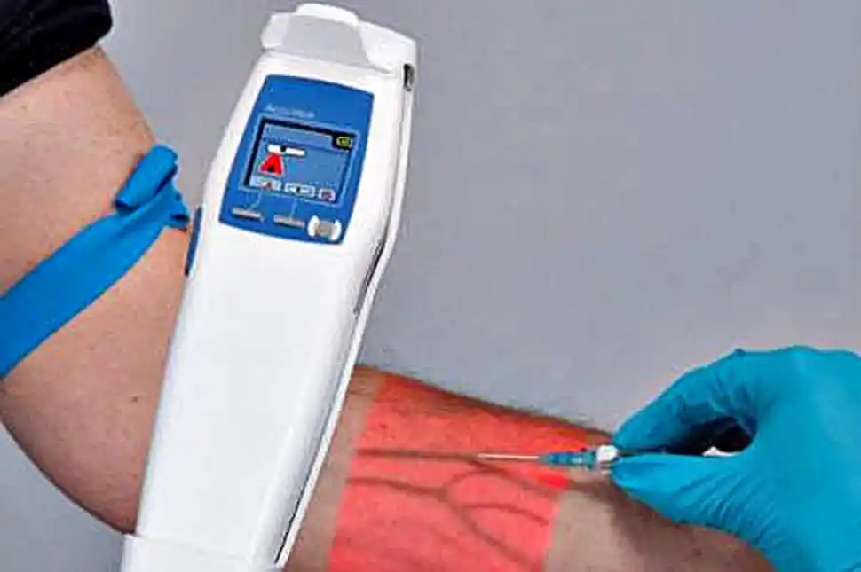 SCANNER. Permite localizar venas y arterias para una extracción segura. 