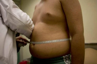 La obesidad implica mayor riesgo de asma