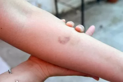 La familia allanada por error reclama explicaciones