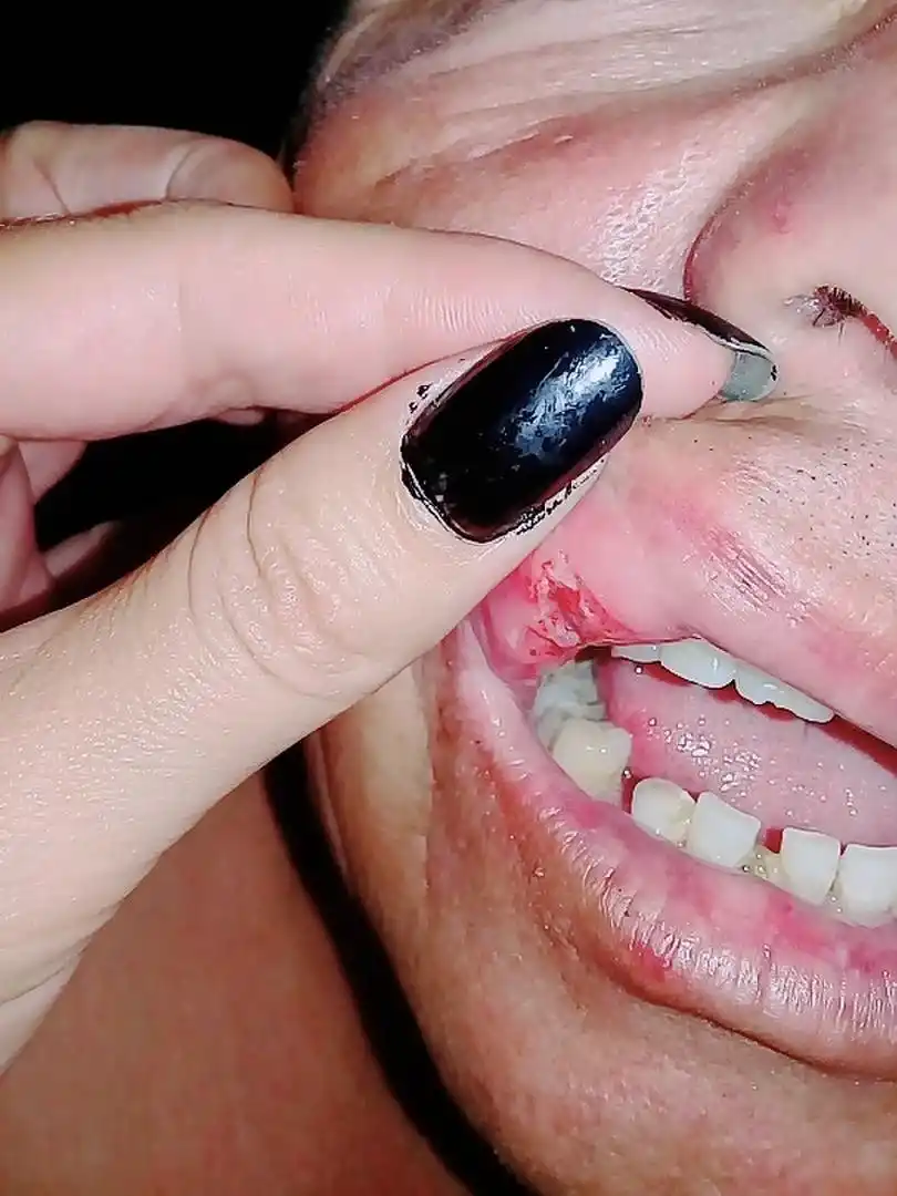 PRUEBAS. Antes de ser internado, los familiares de la víctima fotografiaron las lesiones que sufrió Acuña. 