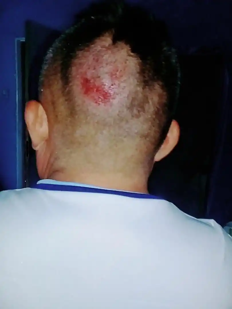 LA VÍCTIMA. Ramón Acuña tenía 55 años y era padre de siete hijos.