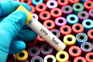 Se podría terminar en un siglo con el cáncer de cuello de útero