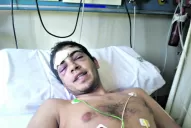 Denuncian que le fracturaron el cráneo con una botella dentro de un boliche