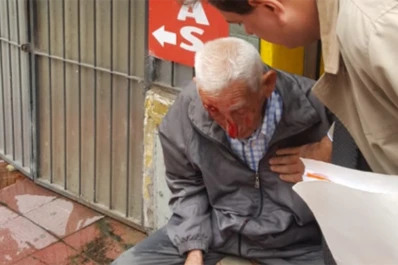 En pleno centro: un hombre de 90 años se tropezó y sufrió una fractura de nariz
