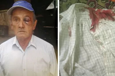 Golpearon y ataron a un hombre de 89 años en la zona rural de Burruyacu