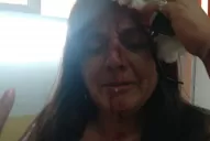 Inseguridad: brutal ataque a una mujer para robarle la cartera