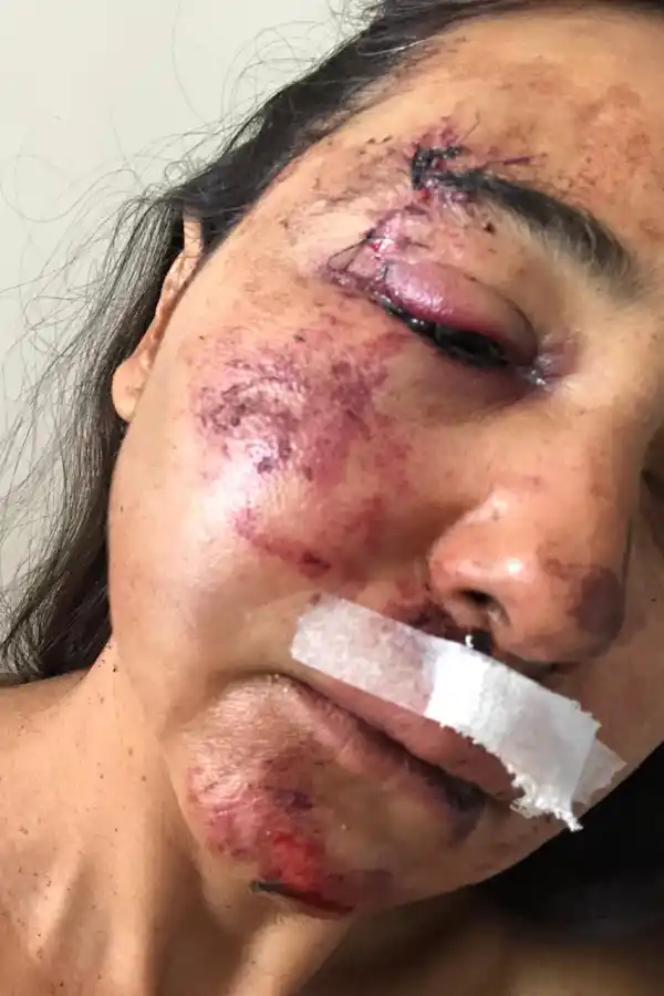 Inseguridad: la golpearon salvajemente y, en la comisaría, no le tomaron la denuncia