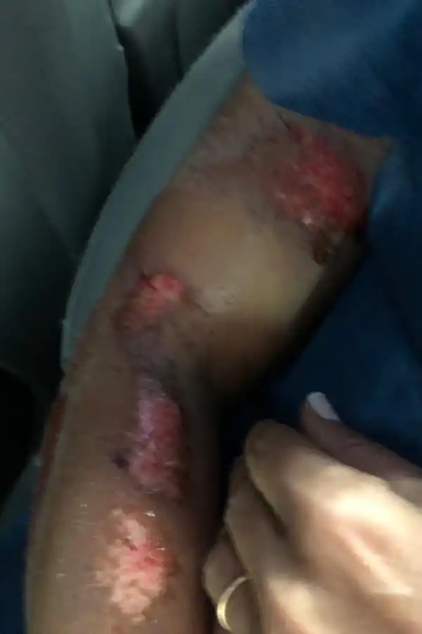 Inseguridad: la golpearon salvajemente y, en la comisaría, no le tomaron la denuncia