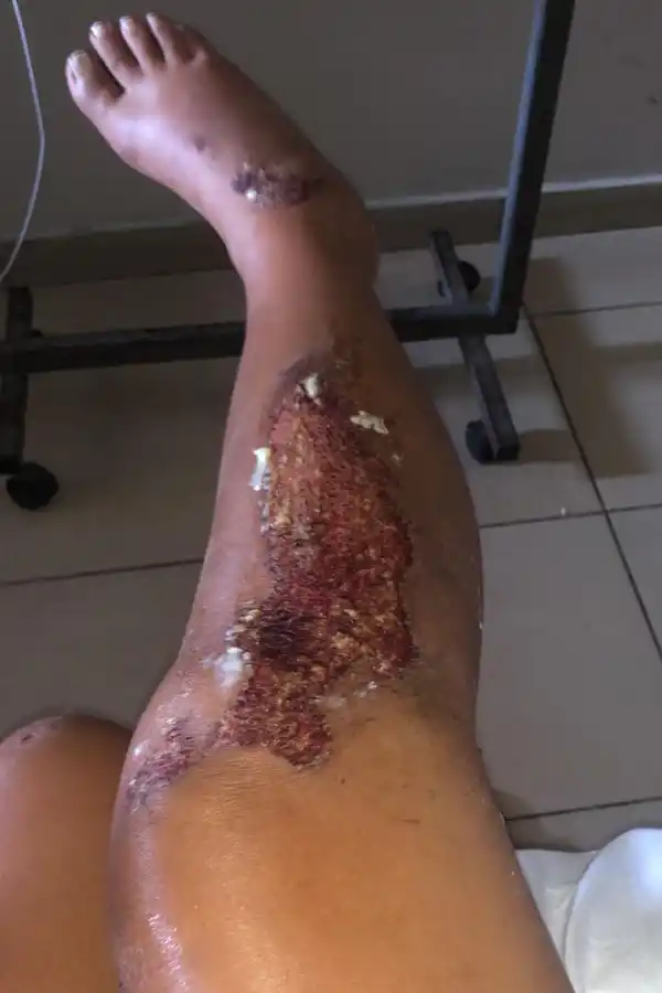 Inseguridad: la golpearon salvajemente y, en la comisaría, no le tomaron la denuncia