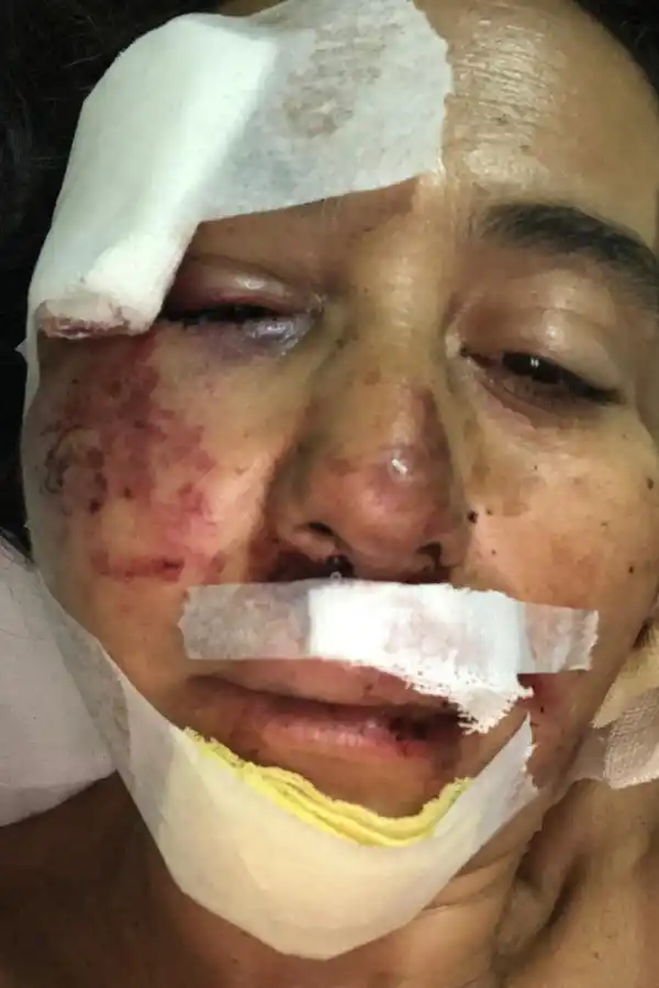 Inseguridad: la golpearon salvajemente y, en la comisaría, no le tomaron la denuncia