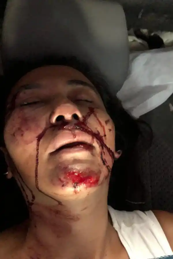 Inseguridad: la golpearon salvajemente y, en la comisaría, no le tomaron la denuncia