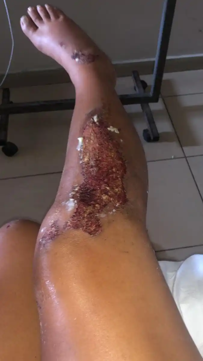 Inseguridad: la golpearon salvajemente y, en la comisaría, no le tomaron la denuncia