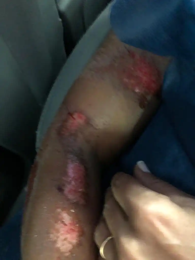 Inseguridad: la golpearon salvajemente y, en la comisaría, no le tomaron la denuncia