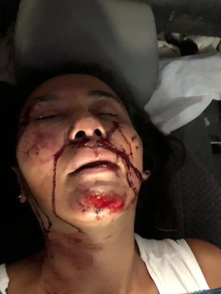 Inseguridad: la golpearon salvajemente y, en la comisaría, no le tomaron la denuncia