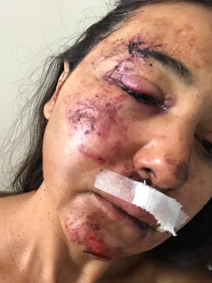 Inseguridad: la golpearon salvajemente y, en la comisaría, no le tomaron la denuncia