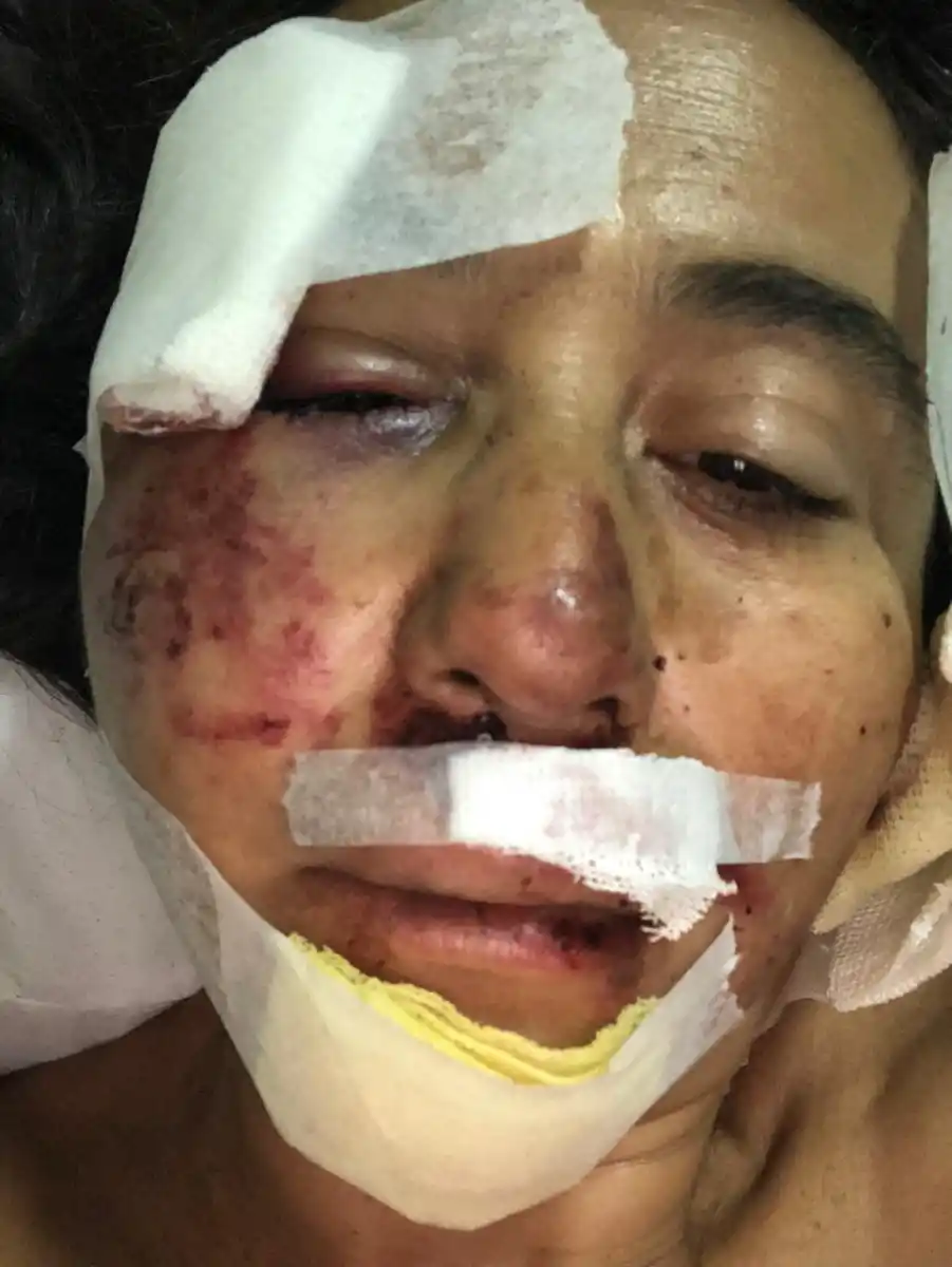 Inseguridad: la golpearon salvajemente y, en la comisaría, no le tomaron la denuncia