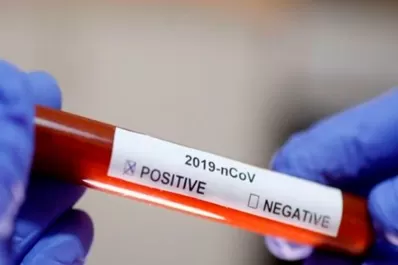 Adelanto: entrevista exclusiva con la primera tucumana diagnosticada con coronavirus