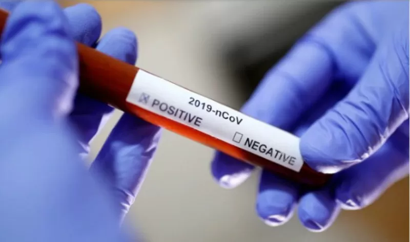 Nueva York empieza a fabricar test de coronavirus: serían 50.000 por semana