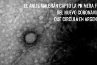 Revelan la primera imagen del coronavirus que circula por Argentina