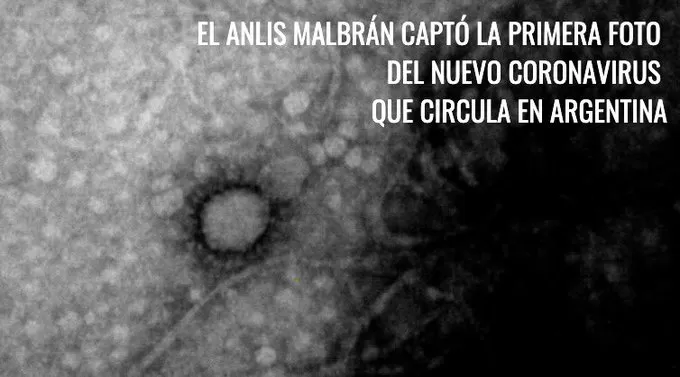 Revelan la primera imagen del coronavirus que circula por Argentina