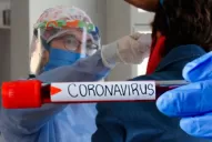 Un joven de 21 años es el paciente 35 con covid-19 en Tucumán