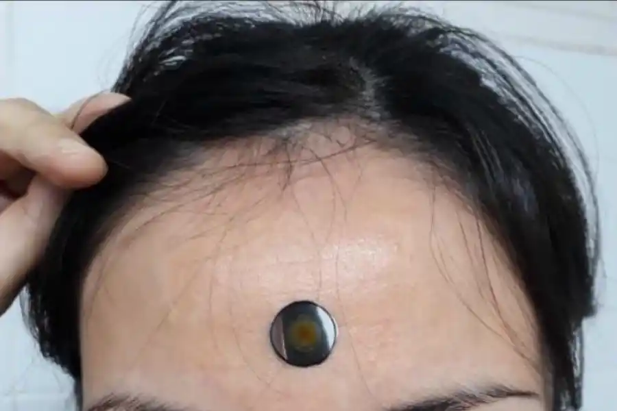 Tucumanos crearon un termómetro adhesivo que indica si alguien tiene fiebre en segundos