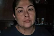 Romina cuenta su padecimiento: tuve dos veces dengue y esto es lo que aprendí